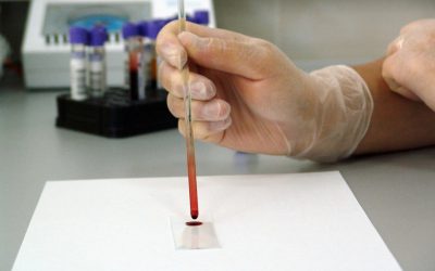Łomża: Lista miejsc, w których można zrobić badania laboratoryjne